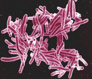 What are Tuberculosis bacteria