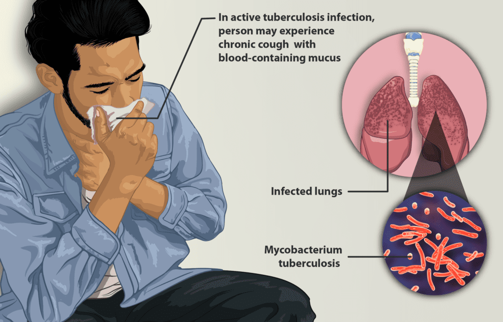 What are Tuberculosis bacteria