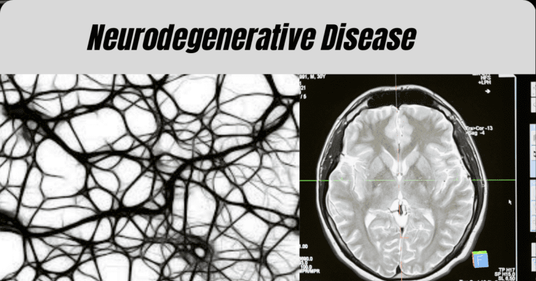 Types of Neurodegenerative Disease