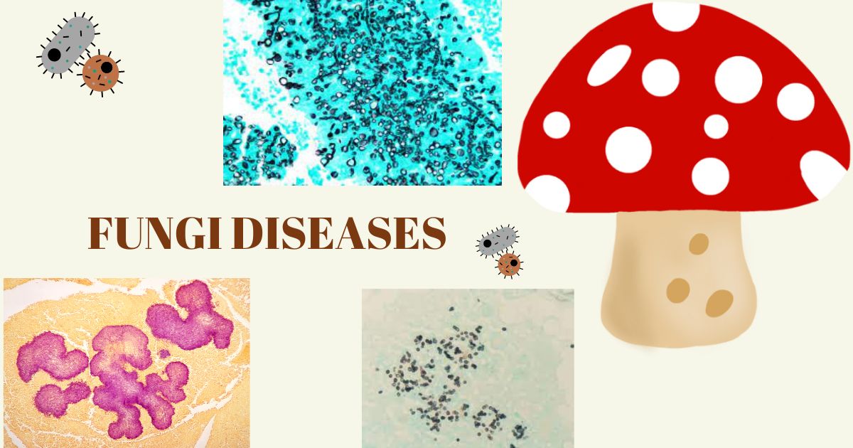 Fungi Diseases