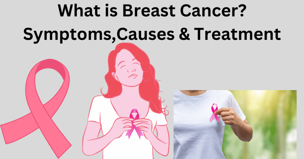 What Is Breast Cancer? - 10 Types Of Breast Cancer- Symptoms,Causes ...