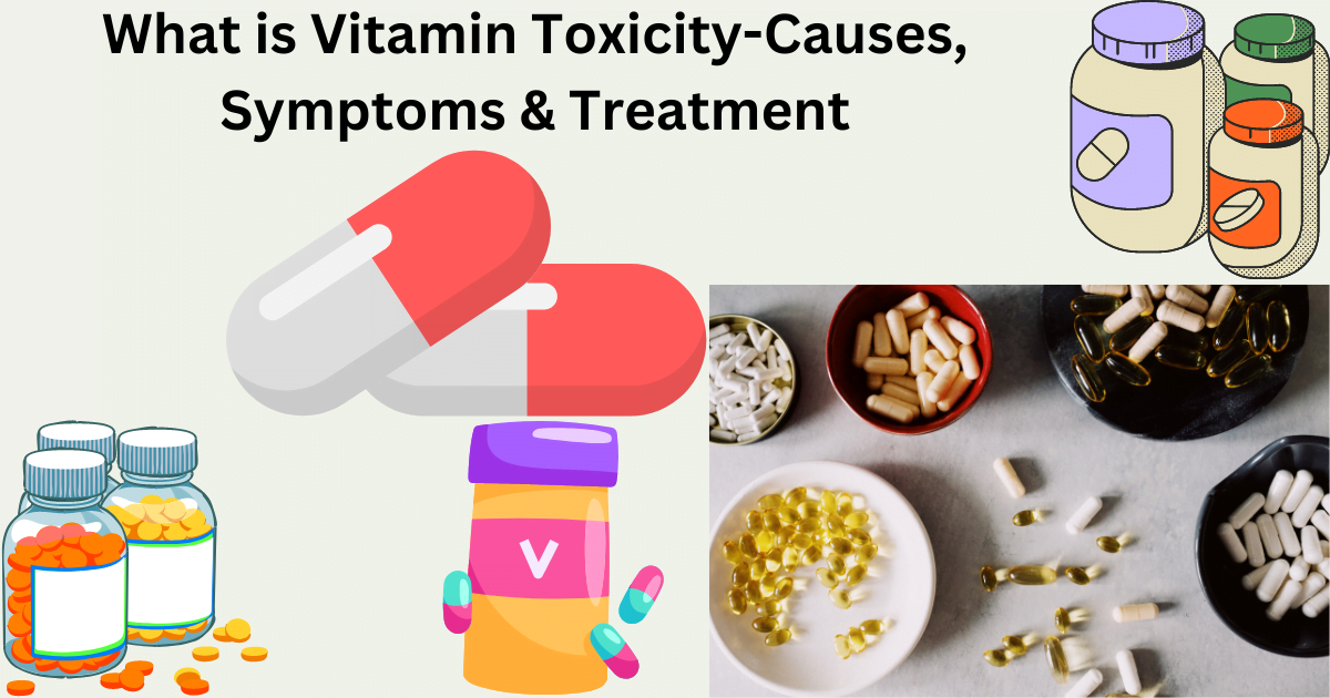 What is Vitamin Toxicity