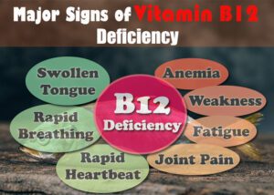 Vitamin B12 Deficiency