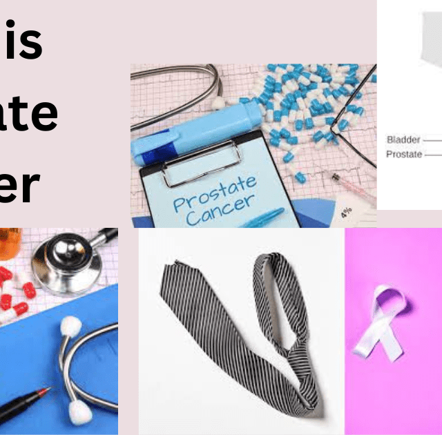 Understanding Kidney Cancer Top 3 Types Causes Symptoms And understanding-kidney-cancer-top-3-types-causes-symptoms-and