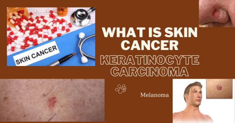 what is Skin cancer