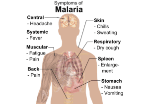 Malaria