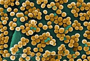 what is staphylococcus aureus