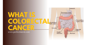 What is colorectal cancer