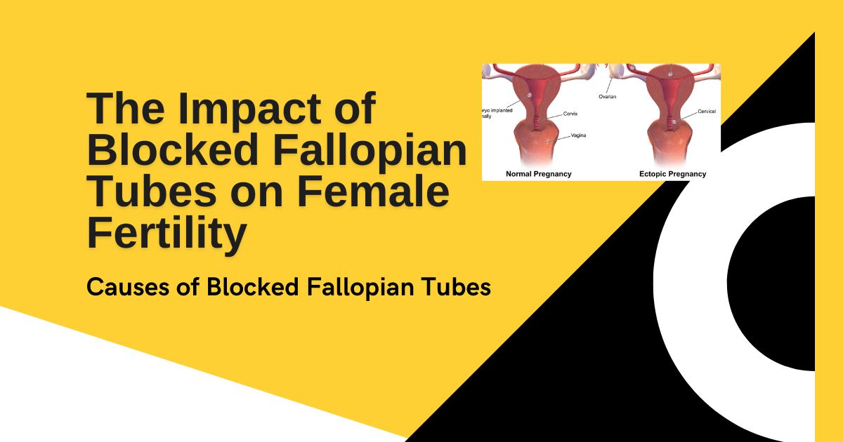 Blocked Fallopian Tubes